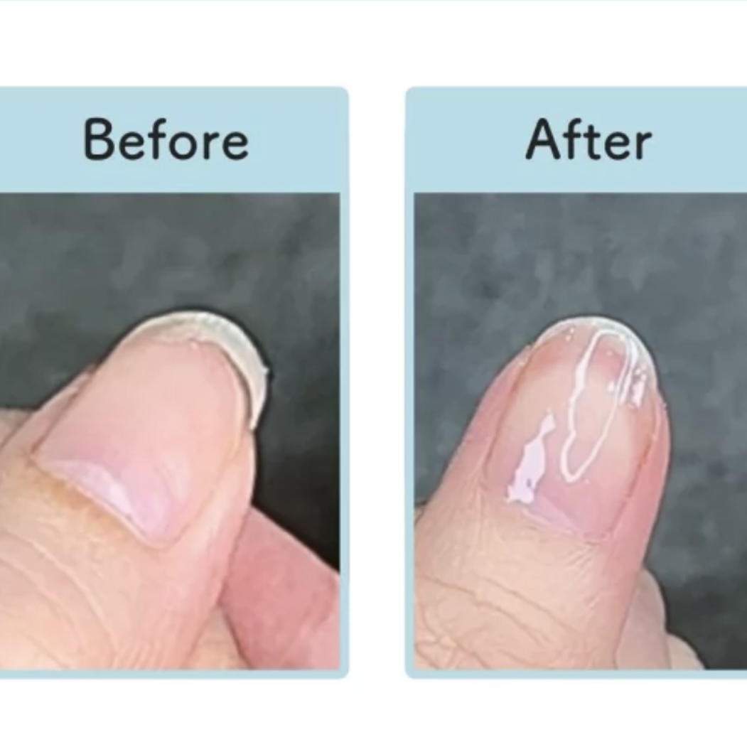 亀裂補正シルクラップ1本の画像